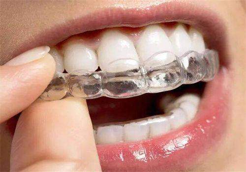 莆田皓雅口腔門診部吳金杰牙齒矯正好不好預約？看完這篇就知道答案啦！ 