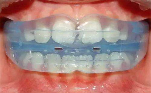 價格公開透明,性價比高