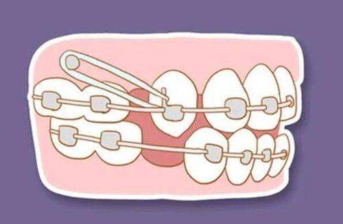 口腔行業價格治理與佛山國笑口腔