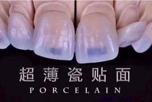 佛山國笑口腔(彩虹店)收費貴嗎？一文揭秘其收費是否合理，看完你就懂！ 