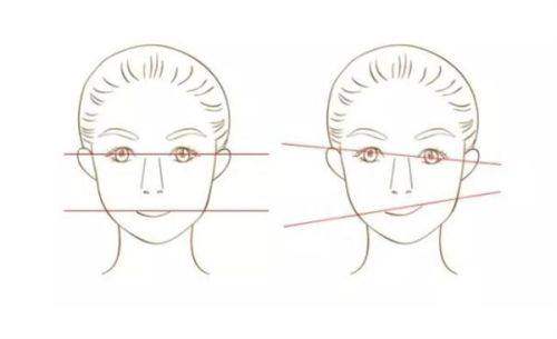 佛山君美整形美容医院:双眼皮手术的专精解读