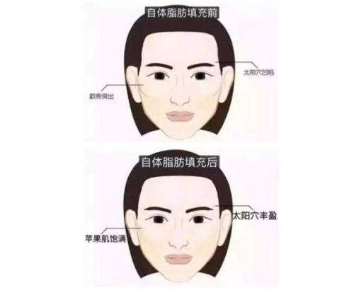 苏州康美美容医院隆胸项目特色与价格