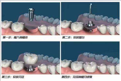 医生团队:经验多,技术不错