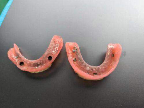 莆田皓雅口腔门诊部：患者的良好反馈