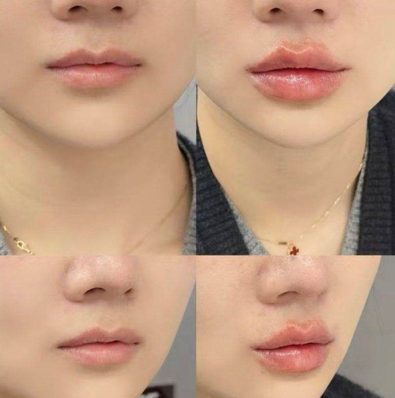 北京知音医疗美容门诊部的多样靠谱项目