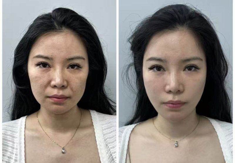 佛山君美整形美容医院:特色项目与专精服务