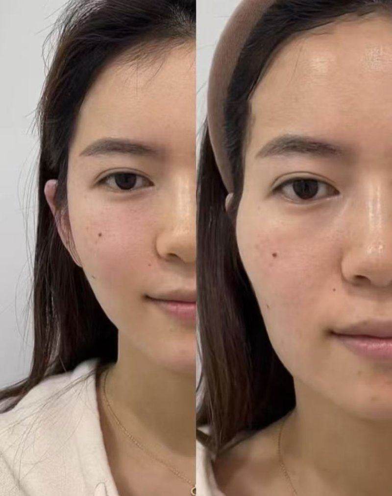 佛山君美整形美容医院:整形美容知识科普