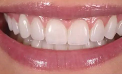 常德辰星口腔門診部的價格情況