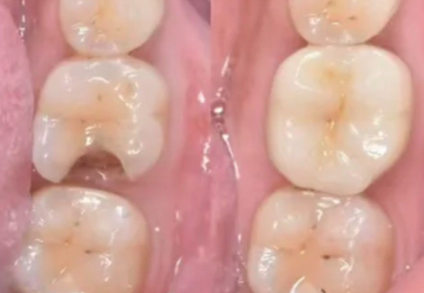 常德辰星口腔门诊部在哪个位置？告诉你具体地址，还有口碑和服务情况介绍！ 