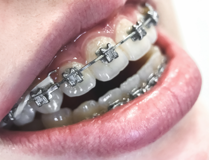 莆田皓雅口腔門診部：管理規範，服務貼心