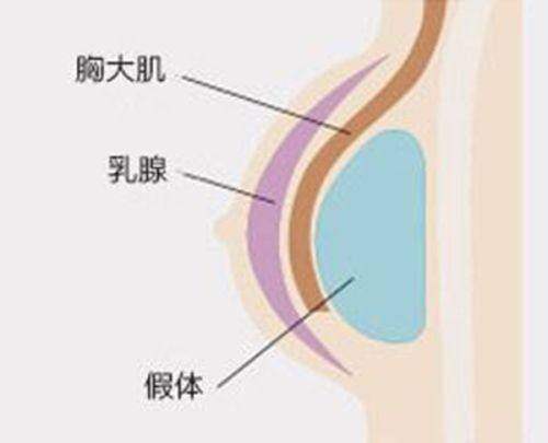 深圳米兰柏羽医疗美容医院与其他医院的收费对比