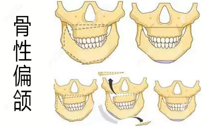 北京五维医疗美容医院马琳是正规的吗？放心，资质全经验足，值得信赖！ 