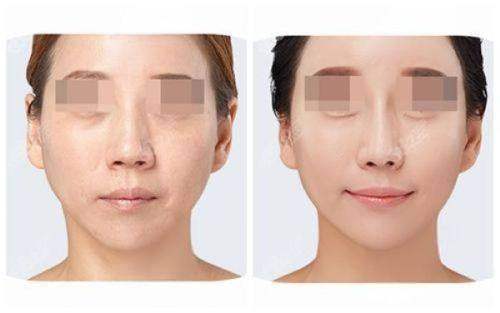 深圳米兰柏羽医疗美容医院的优质服务