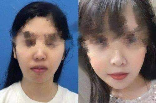 张家口维多利亚医疗美容:“3H”管理与“6S”服务,享受身心愉悦变得更美之旅