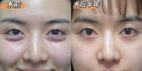 上海华美医疗美容医院