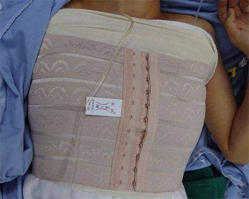 深圳米兰柏羽医疗美容医院的价格透明度