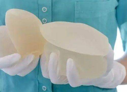 上海星和医疗美容医院顾客眼中的吴捷医生