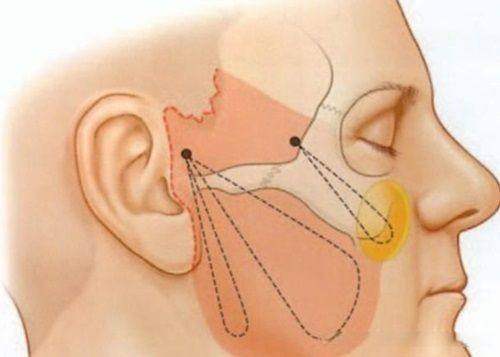 上海星和医疗美容医院公交怎么坐？别愁，这篇攻略告诉你便捷又省心的乘坐方式