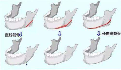 上海星和医疗美容医院——曾经的小插曲