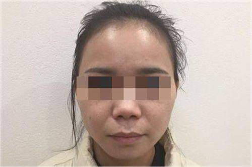 深圳米兰柏羽医疗美容医院的过往表现