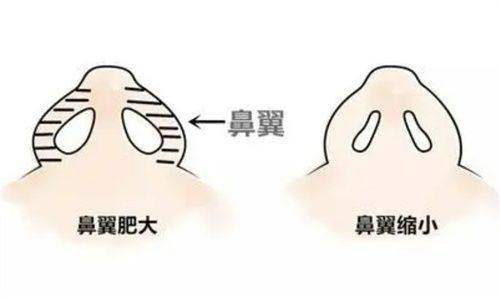 北京五维医疗美容医院怎么乘地铁去？超详细路线攻略，让你轻松直达变美圣地！ 