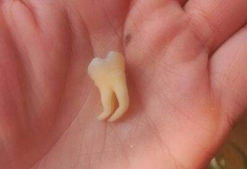 口腔行業亂象叢生，患者需謹慎選擇