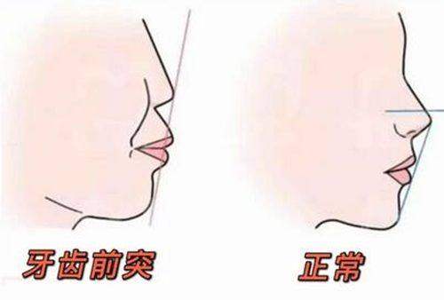 不同口腔門診部的價格之謎