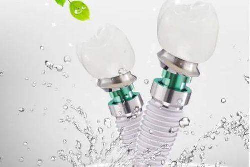 綿陽中綿口腔醫院怎麼樣？實力揭秘：價格便宜≠質量打折