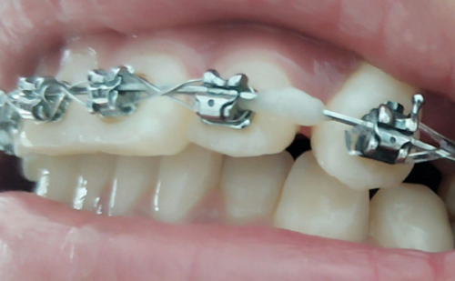 山西省山西晋城牙博士口腔門診部：價格表性價比高