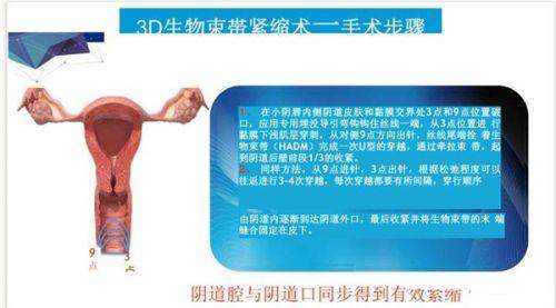 北京五维医疗美容医院怎么乘地铁去？这篇攻略给你超详细的路线指引！ 