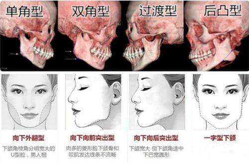 张家口维多利亚医疗美容医院:精良的设备与技术