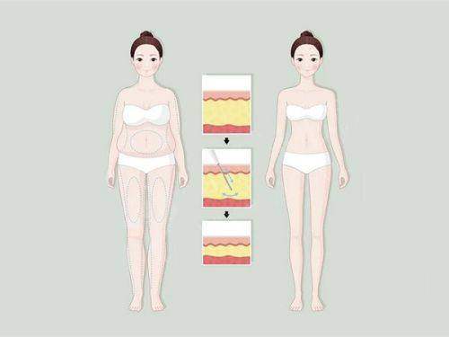 张家口维多利亚医疗美容医院:真实口碑,见证美丽