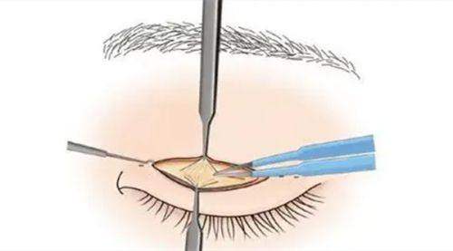 深圳米兰柏羽医疗美容医院的收费与性价比