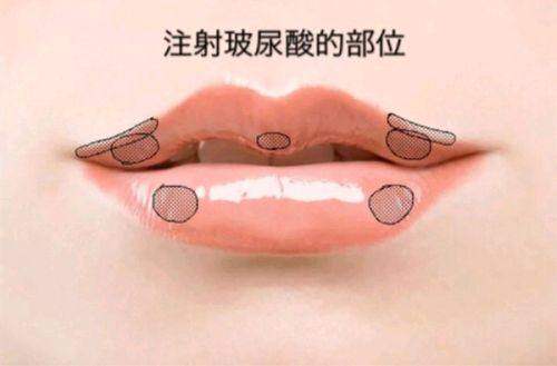 北京五维医疗美容医院周边地铁站情况