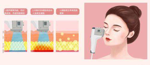 吴捷医生的技术资历和业内口碑