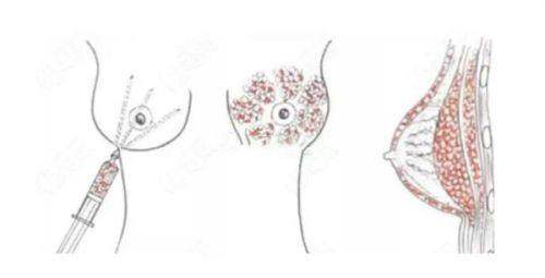 复旦大学附属中山医院整形外科