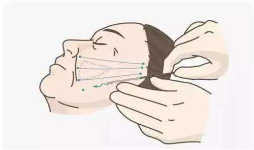 张家口维多利亚医疗美容:部分热门项目价格参考