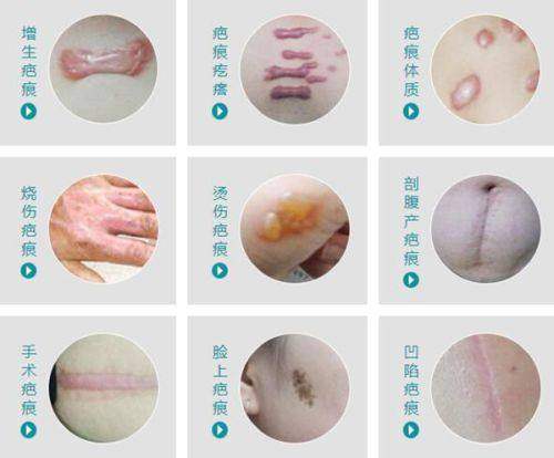 在线询问了解更多