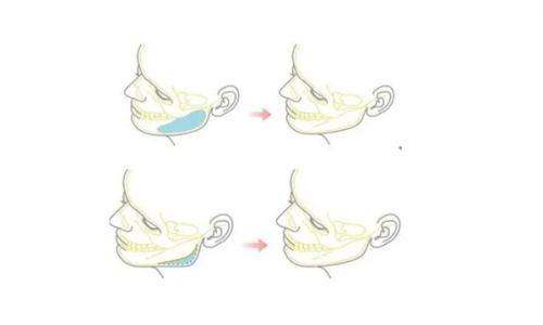 2025年上海综合医美项目价格及相关信息