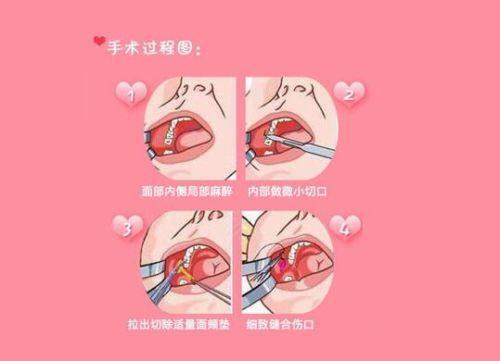 上海星和医疗美容医院吴捷医生的价格合理性