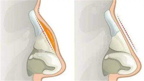 张家口维多利亚医疗美容医院热门医美项目