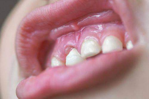 山西晉中口腔醫院:地區因素對費用的作用