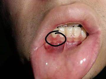 山西晉中口腔醫院：醫保情況對費用的影響