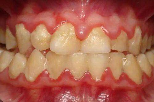 山西運城口腔醫院：醫院選擇對費用的影響