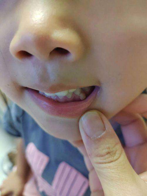 山西運城口腔醫院:醫保情況影響實際支出