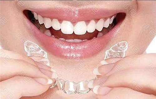 山西省隱形托槽矯正多少錢2026？一文為你揭曉當地矯正費用的真實情況！ 