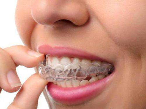 2025太原牙齒矯正收費價格表