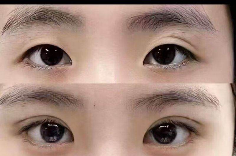 深圳米兰柏羽医疗美容医院的口碑和评价