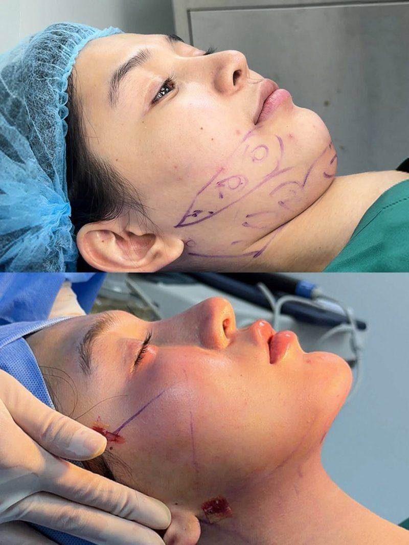 合肥美雅尔口腔门诊部收费标准大揭秘，看看在这看牙、整牙到底花多少钱！ 