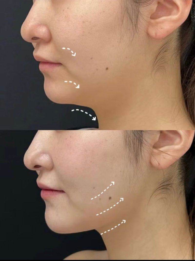 上海美莱医疗美容医院：透明收费赢信任